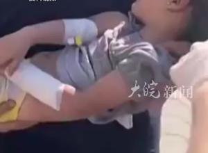 加沙平均每天有10名儿童失去一条或两条腿，许多受伤儿童被迫无麻醉截肢 