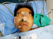 一家4口誤食野生鵝膏菌中毒：1人身亡3人仍在救治 家屬網上籌款
