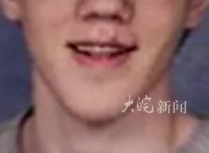 枪击特朗普嫌疑人照片公开，其车中发现爆炸装置