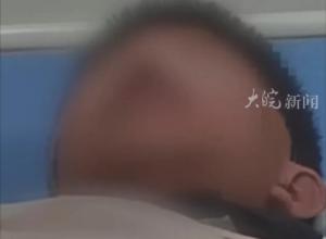 福建一初中生被霸凌 
致下体烧伤、肋骨骨折 
警方介入调查