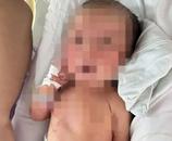 四川被撿到的臍帶未剪嬰兒被診出肺炎、骨折等多種病癥，當(dāng)?shù)鼐交貞?yīng)