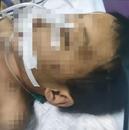3歲半男童被父親女友虐待致腦死亡？警方：涉事女子已被刑拘