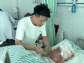 急需援手！安徽舒城一對(duì)夫妻遭遇橫禍被燒傷