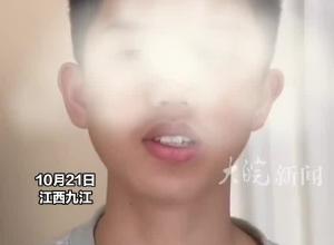 15岁男孩人工耳蜗在宿舍丢失，家长：学校将赔偿7成费用，手术等综合费用相加60多万