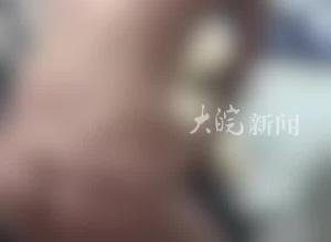 男子用电线抽打两名赤身裸体男孩 重庆江津警方通报：已依法立案  对孩子父亲已采取刑事强制措施

