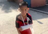家長稱6歲孩子被教練打骨折，河南一武校回應：是助教，警方已介入