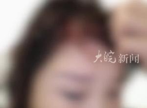四川泸州一女子举报民警丈夫长期家暴，当地回应：妇联介入 正在调查