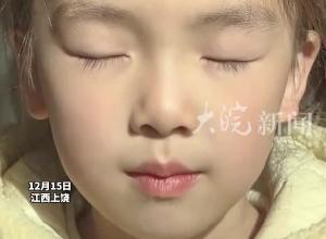 6岁女孩天生异瞳 一只眼睛灰蓝色，检查后得知对视力和听力没有影响，妈妈担心她被孤立 但大家都很喜欢她