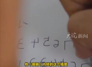 8岁男孩总把数字反着写 
看书没多久就会头疼 
医生:问题出在眼睛上 要多点户外活动，多看远处景色