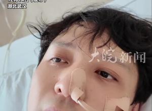 上海东方卫视主持人百克力因误吞鱼刺住院，长4厘米的鱼刺穿出了胃、扎到了肝