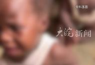 3名幼兒分食死蝙蝠后發病 剛果（金）暴發不明原因疫情 已致50多人死亡