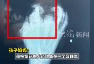 13歲初中生放炮3根手指被炸斷 家長：炸傷的手指沒找到一根全的