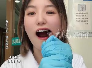女牙科医生自己拔智齿 全程面无表情 云淡风轻 “一颗智齿而已 下次再拔两颗”