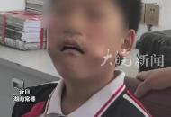 尺子能當癢癢撓？小孩哥換牙期神操作驚呆消防員
