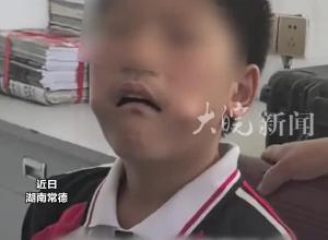 尺子能當癢癢撓？小孩哥換牙期神操作驚呆消防員