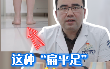 这种“扁平足”可恢复！