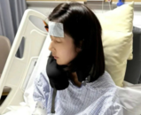 女演员颖儿因胆结石切除胆囊 此病与饮食、生活习惯有关