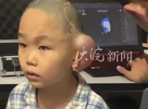 7歲男童放學途中被3只惡狗撕咬， 媽媽：已休學1年 將做再造耳手術